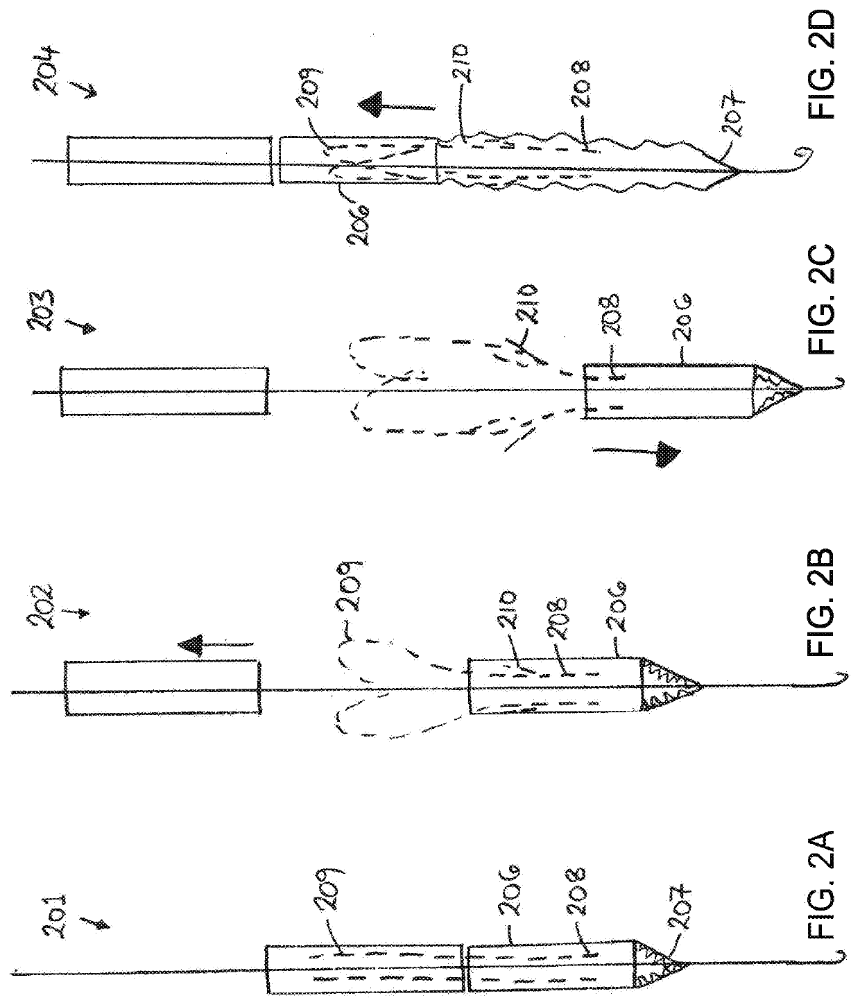 Systems, methods and devices for retrograde pericardial release of a prosthetic heart valve