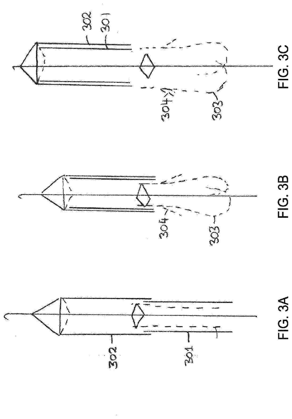 Systems, methods and devices for retrograde pericardial release of a prosthetic heart valve