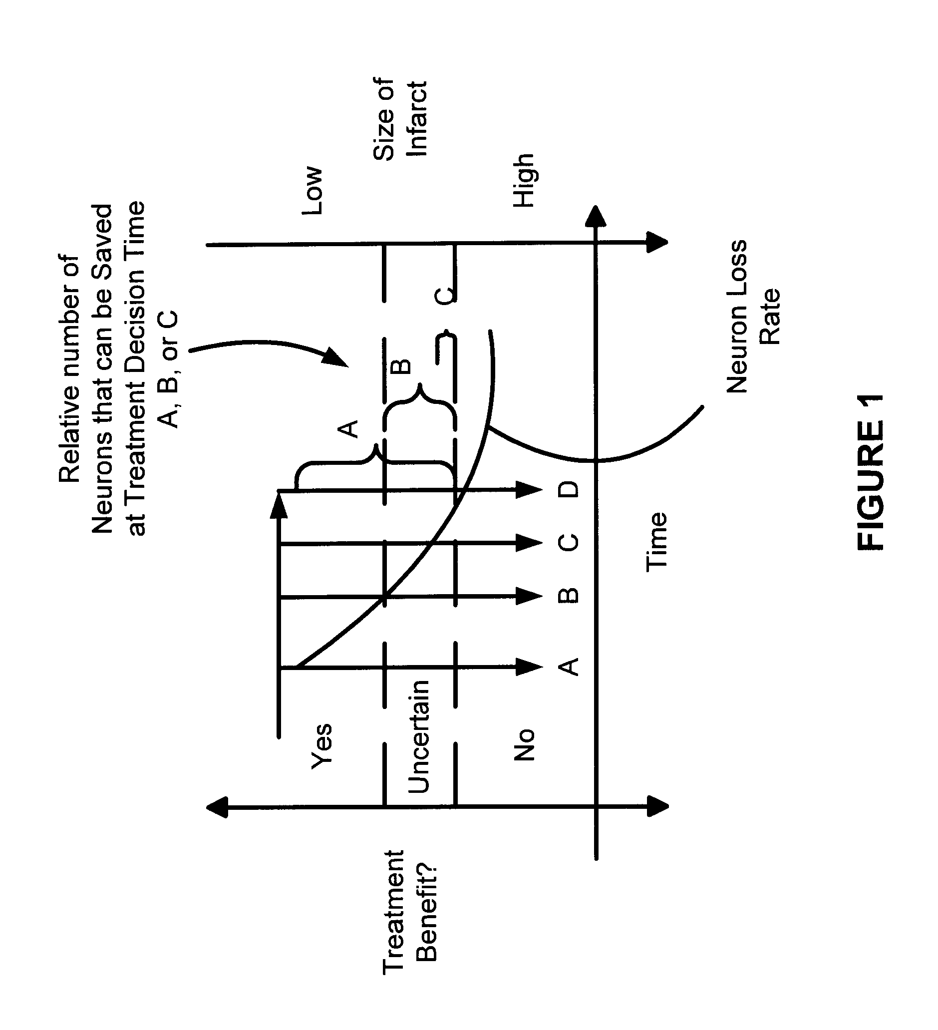 Systems and methods for diagnosing strokes