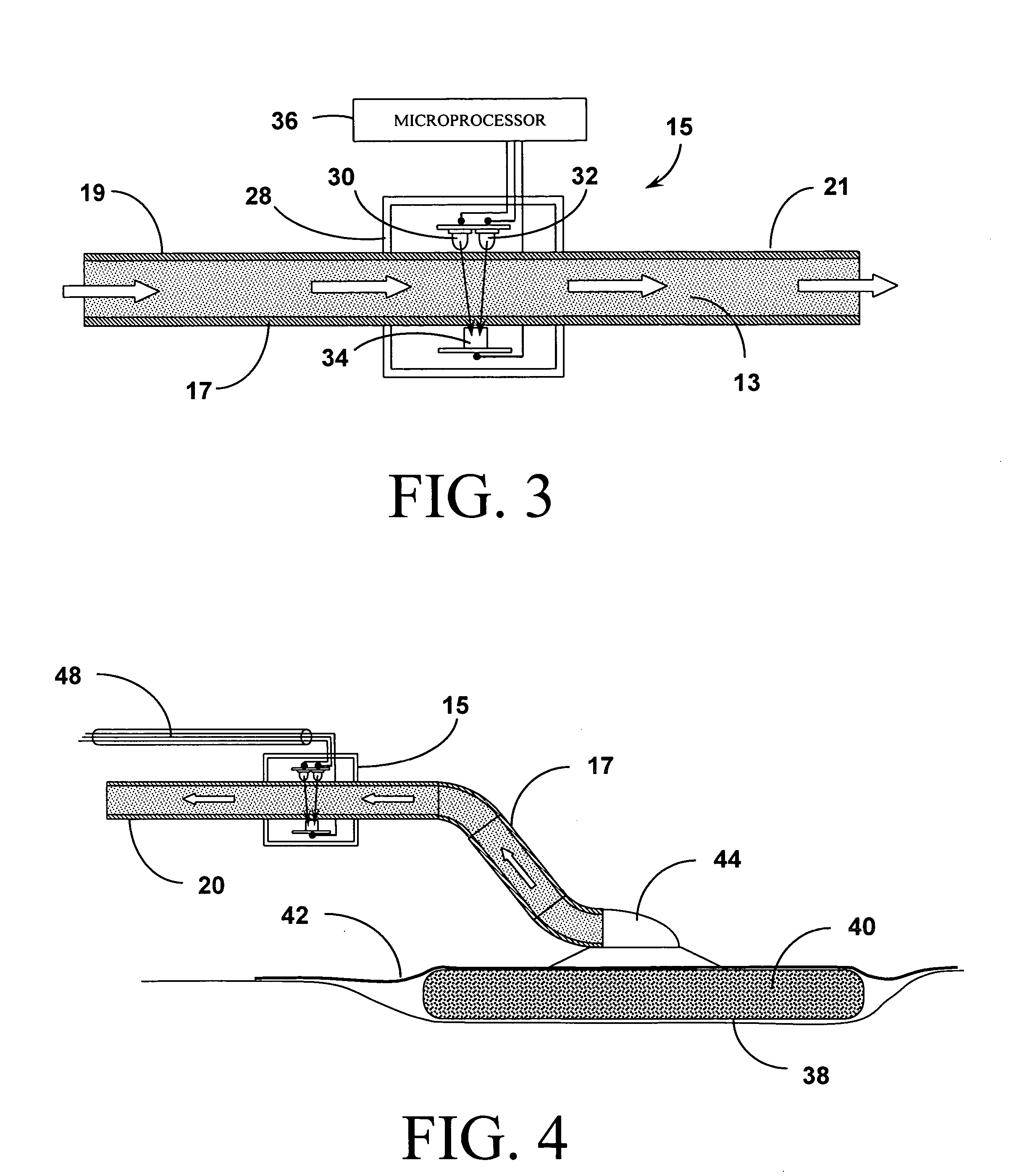 Systems and methods for detection of wound fluid blood and application of phototherapy in conjunction with reduced pressure wound treatment system