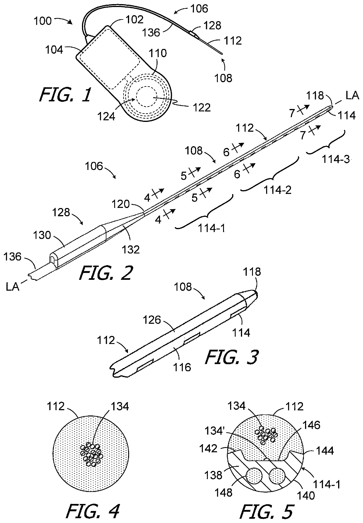 Cochlear implants including electrode arrays and methods of making the same