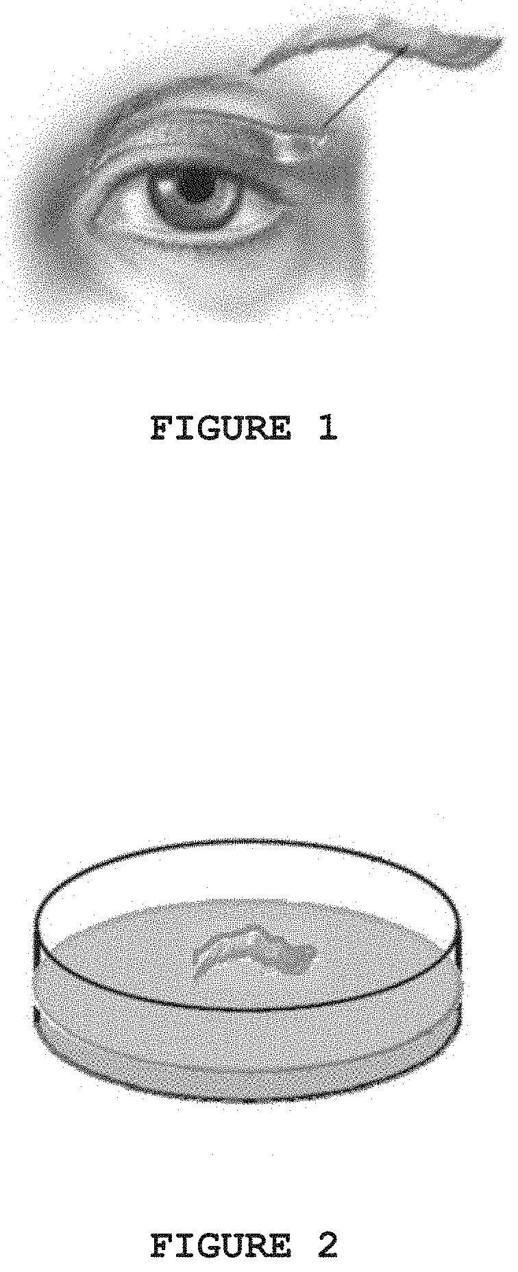 Topical pharmaceutical composition, method for producing the topical pharmaceutical composition, use of topical pharmaceutical composition and method for topical treatment of psoriasis, atopic dermatitis or chronic eczema