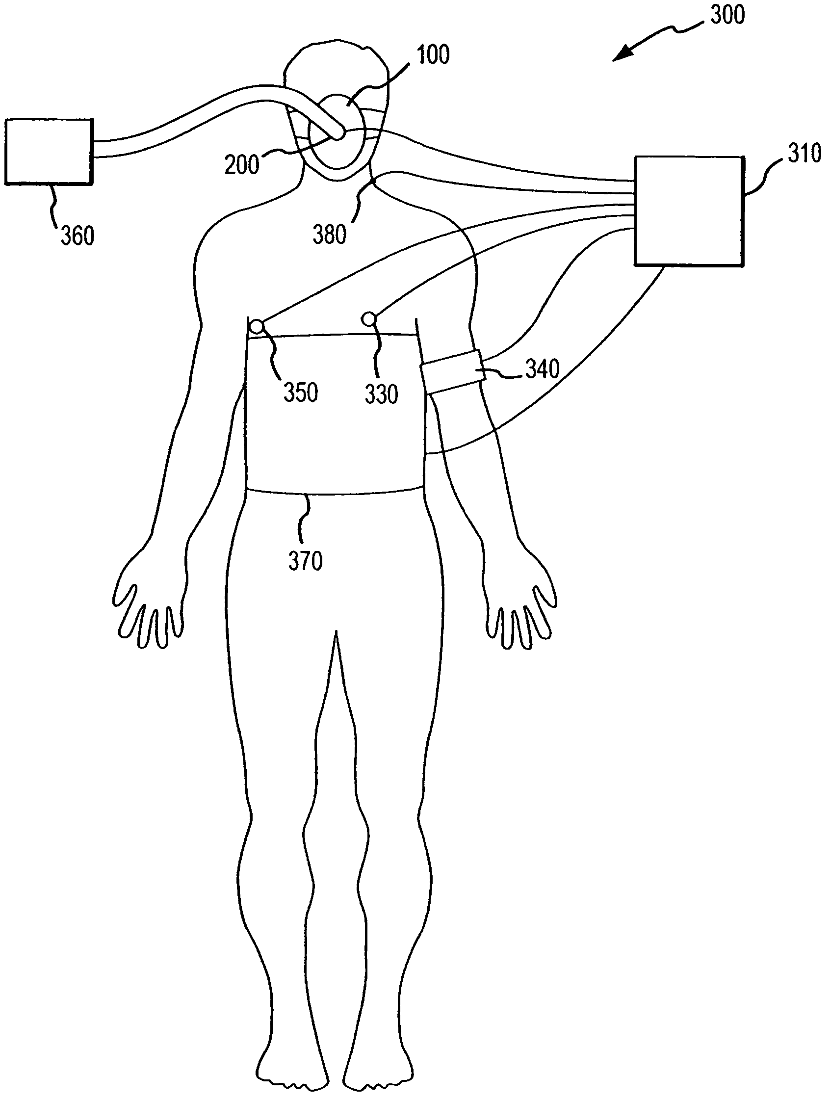 Ventilator and methods for treating head trauma and low blood circulation