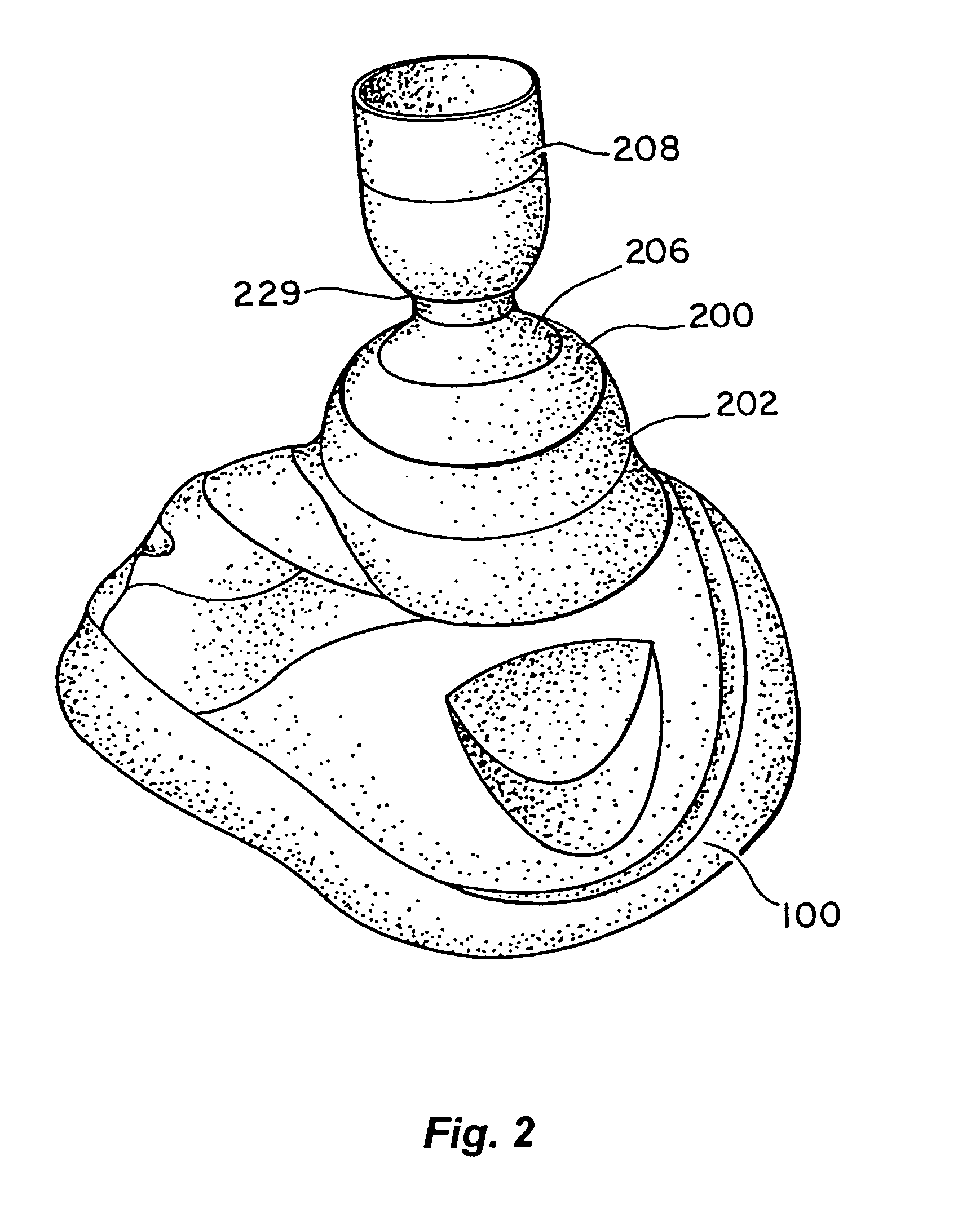 Ventilator and methods for treating head trauma and low blood circulation