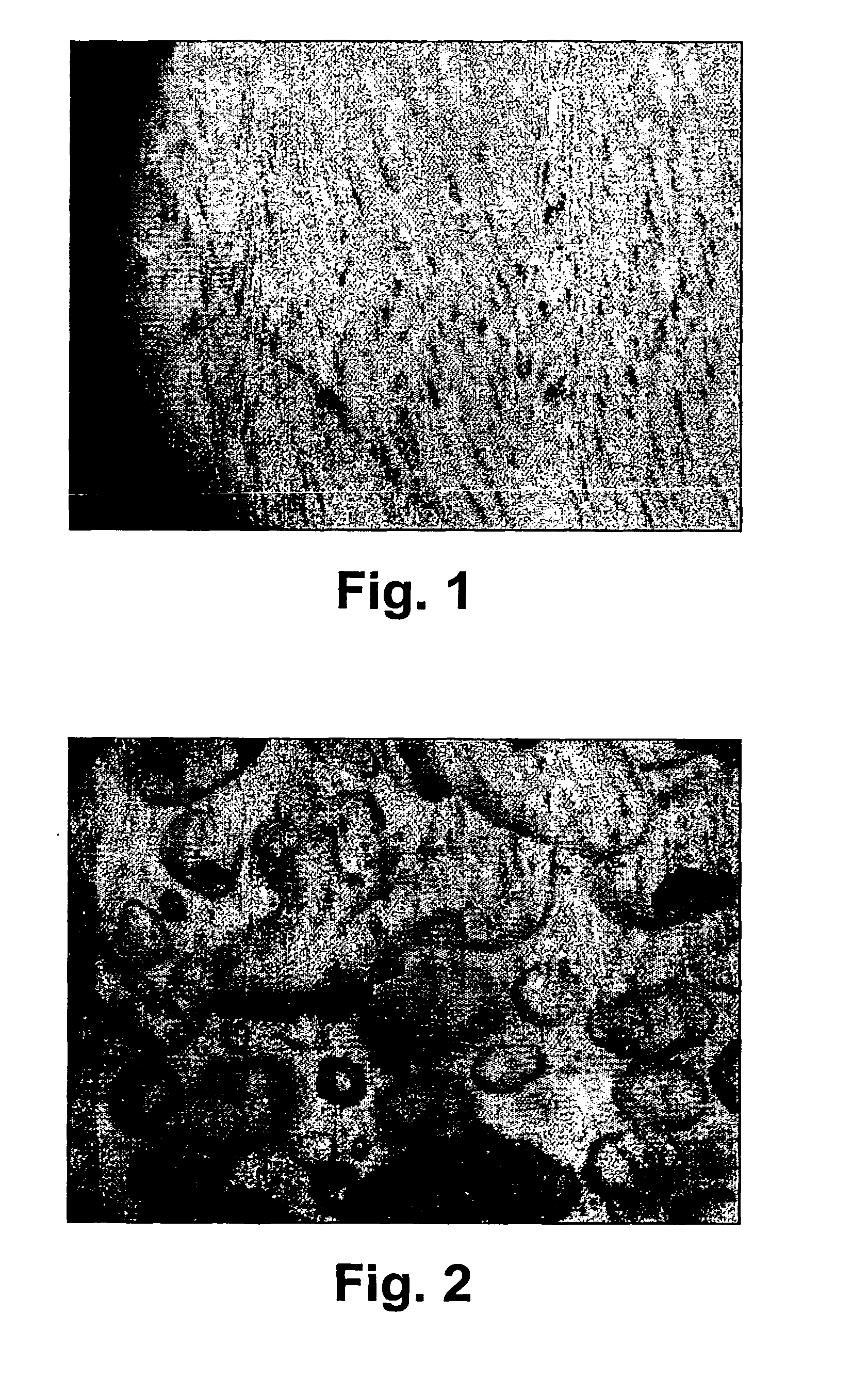 Composition comprising biodegradable hydrating ceramics for controlled drug delivery