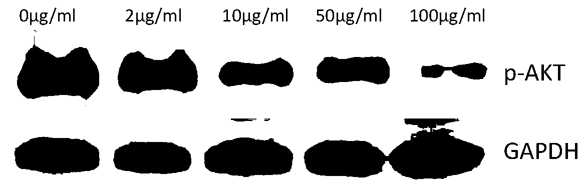 Polypeptide Inducing Prostate Cancer Cell Apoptosis and Its Application