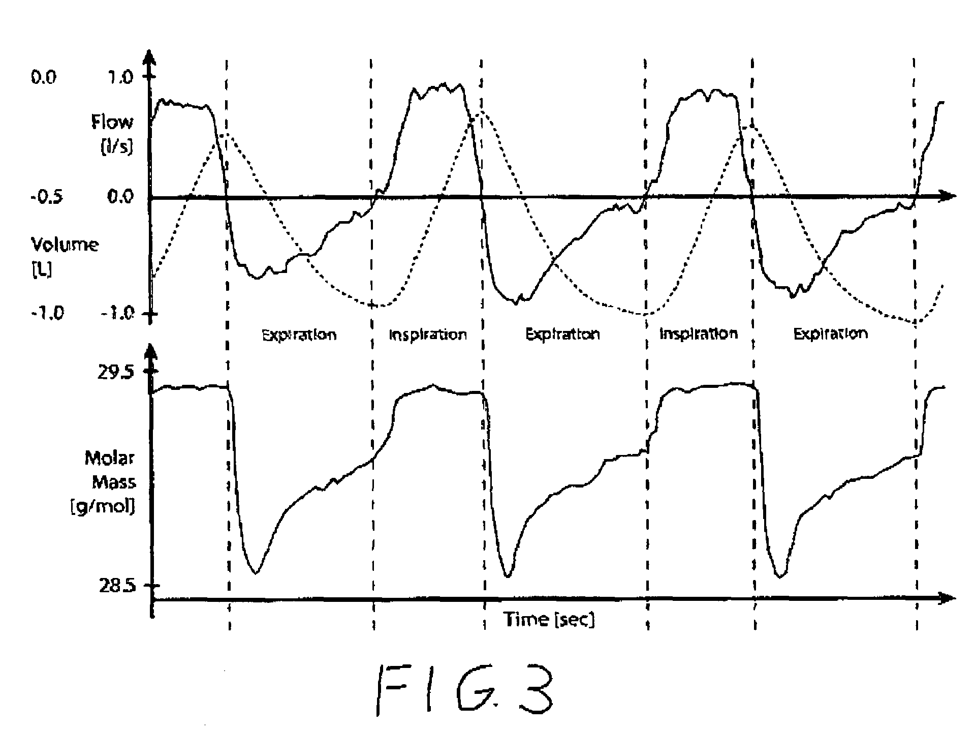 Method for non-cooperative lung function diagnosis using ultrasound