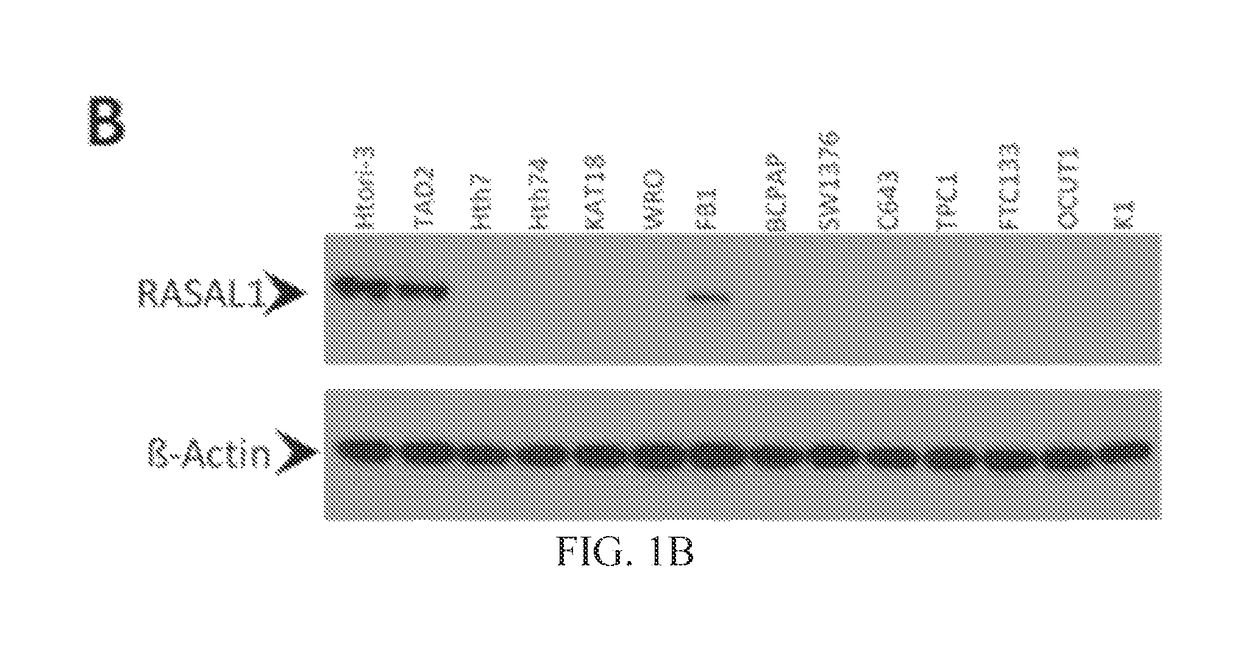 RASAL1 is a major tumor suppressor gene in thyroid cancer