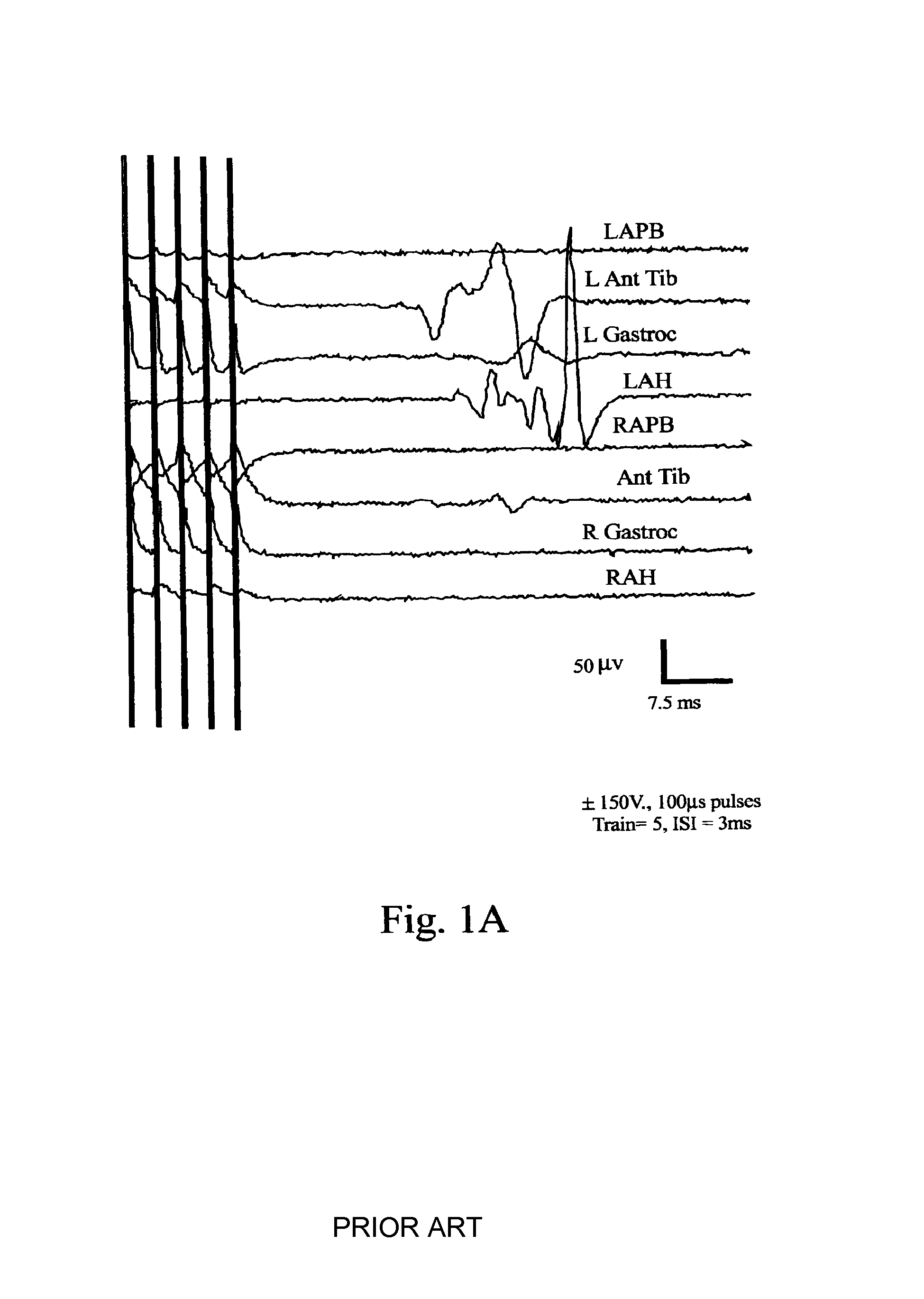 Methods and systems for generating electrical property maps of biological structures