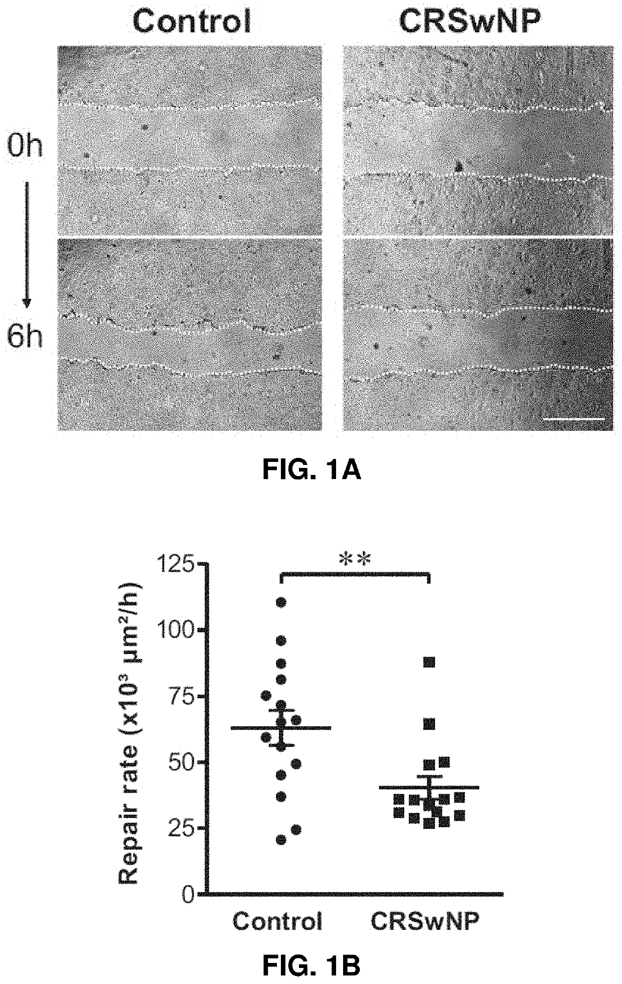 Use of rock inhibitors for promoting sinonasal epithelial cell repair