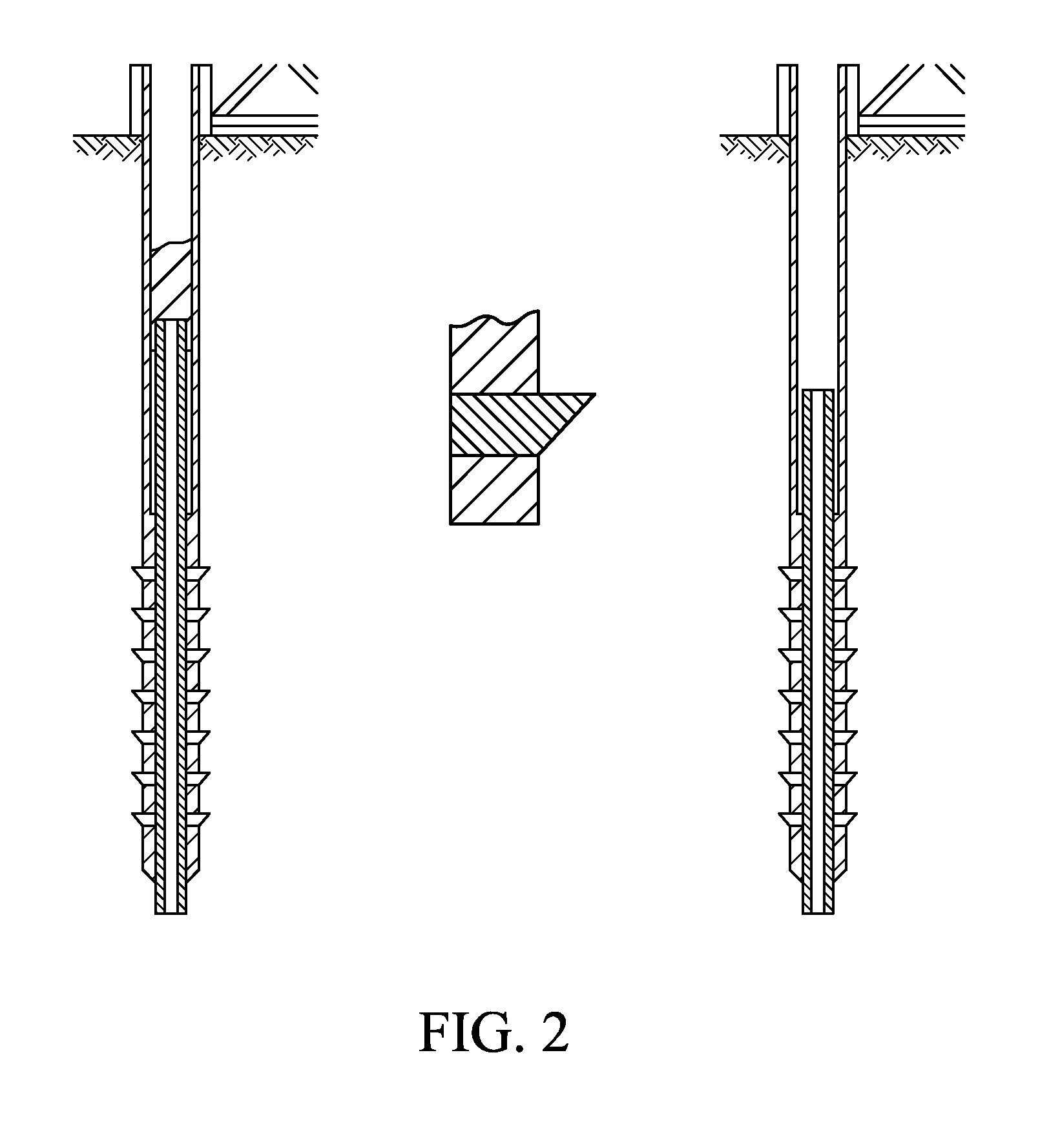 Devices and Methods for Treating Cardiomyopathy