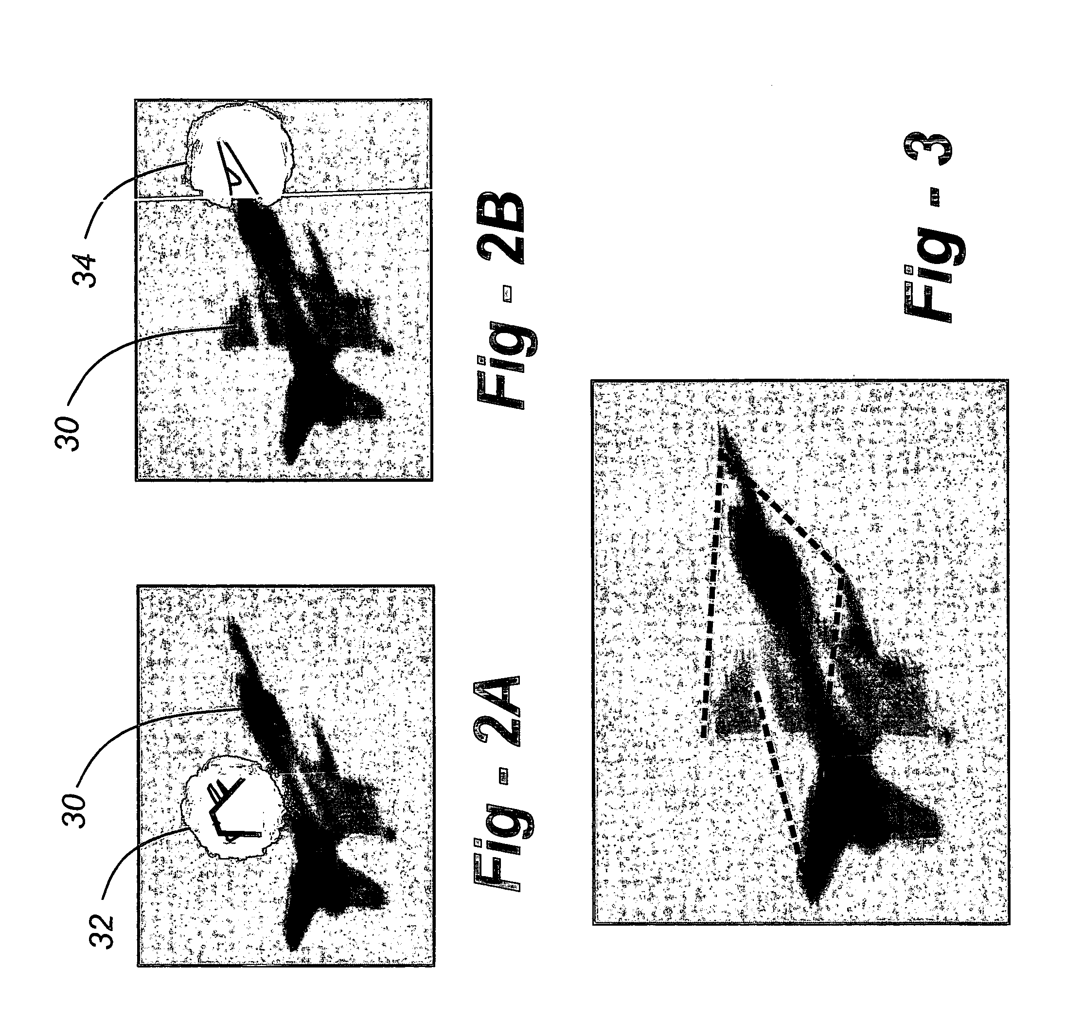 Foveated display eye-tracking system and method