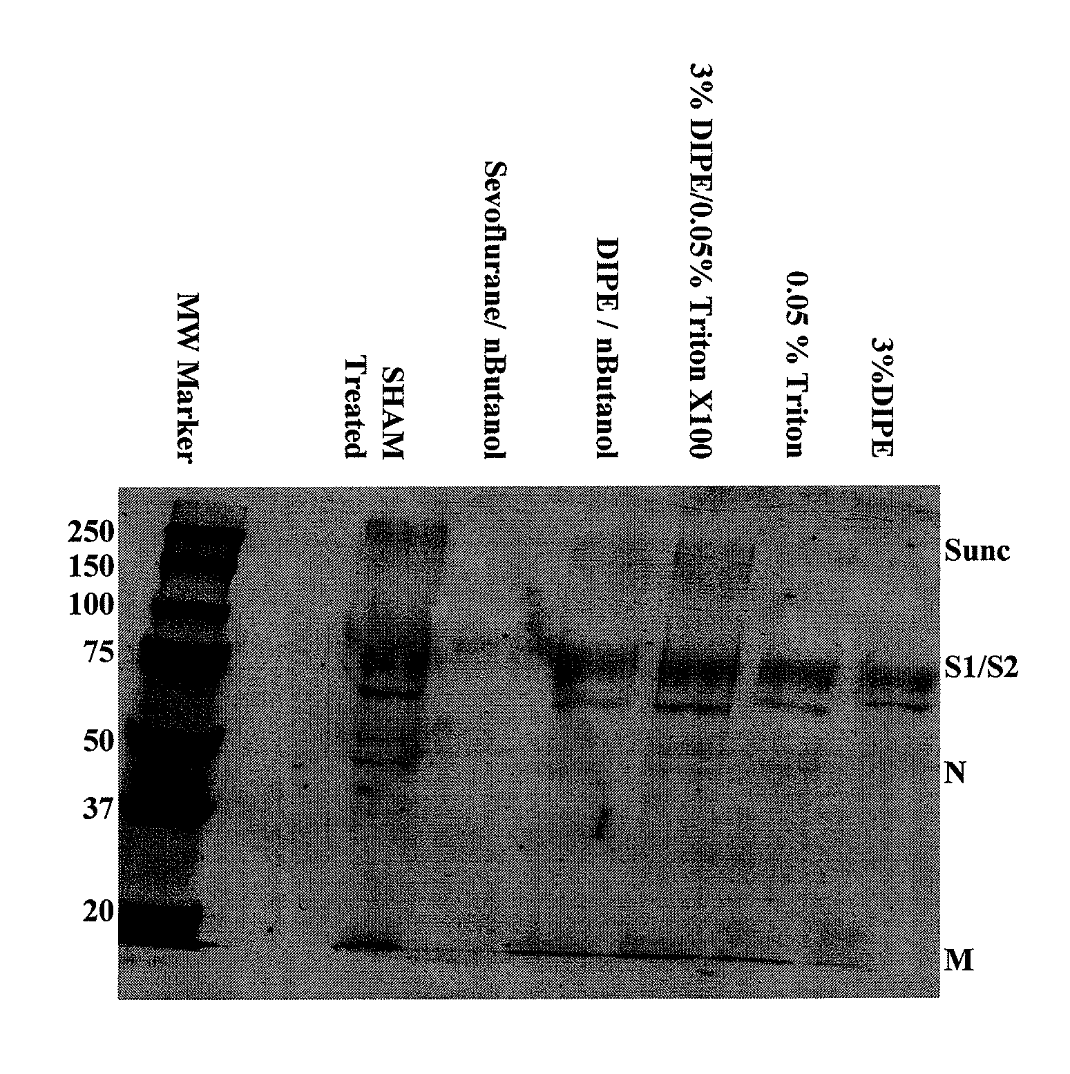 SARS Vaccine Compositions and Methods of Making and Using Them