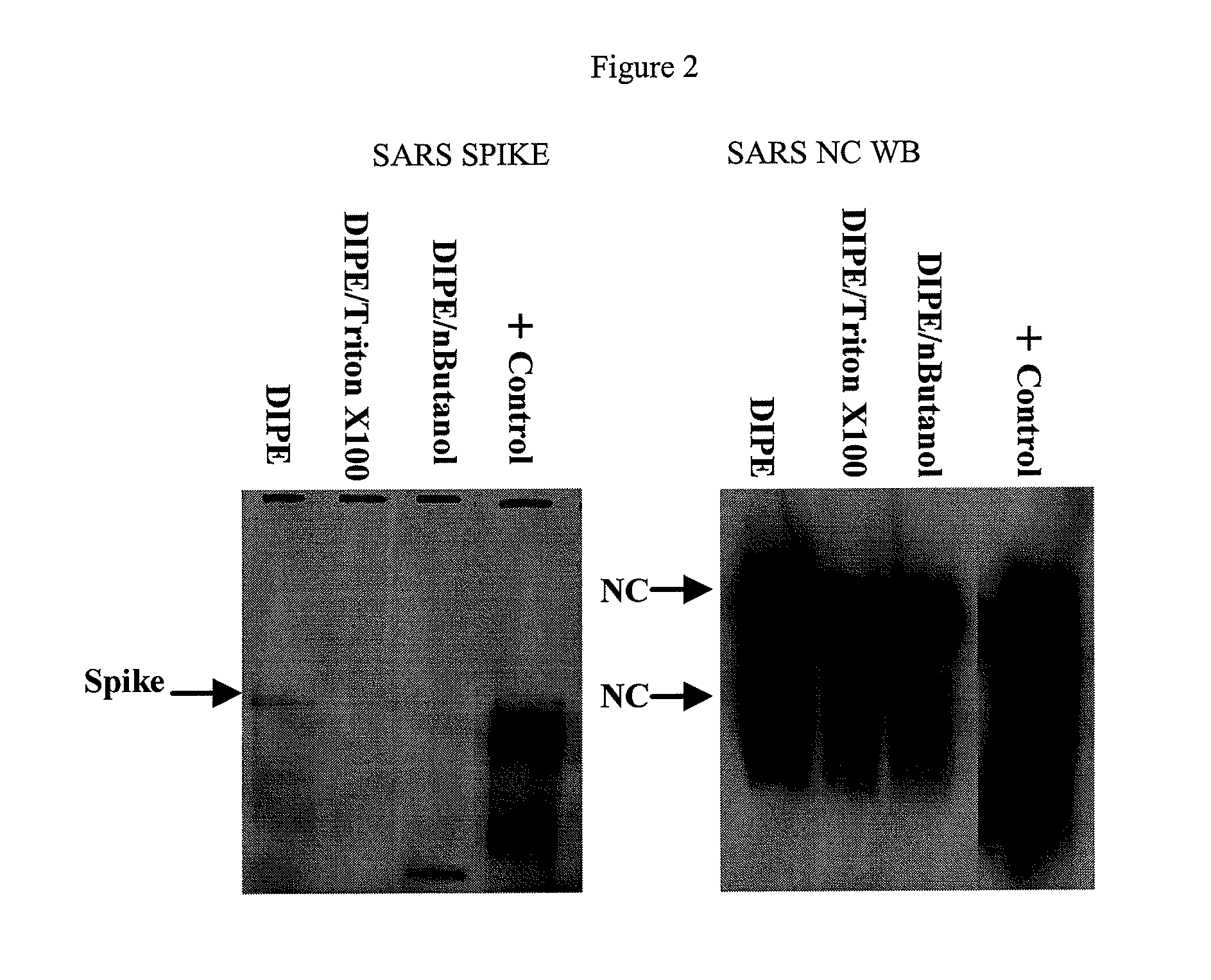 SARS Vaccine Compositions and Methods of Making and Using Them