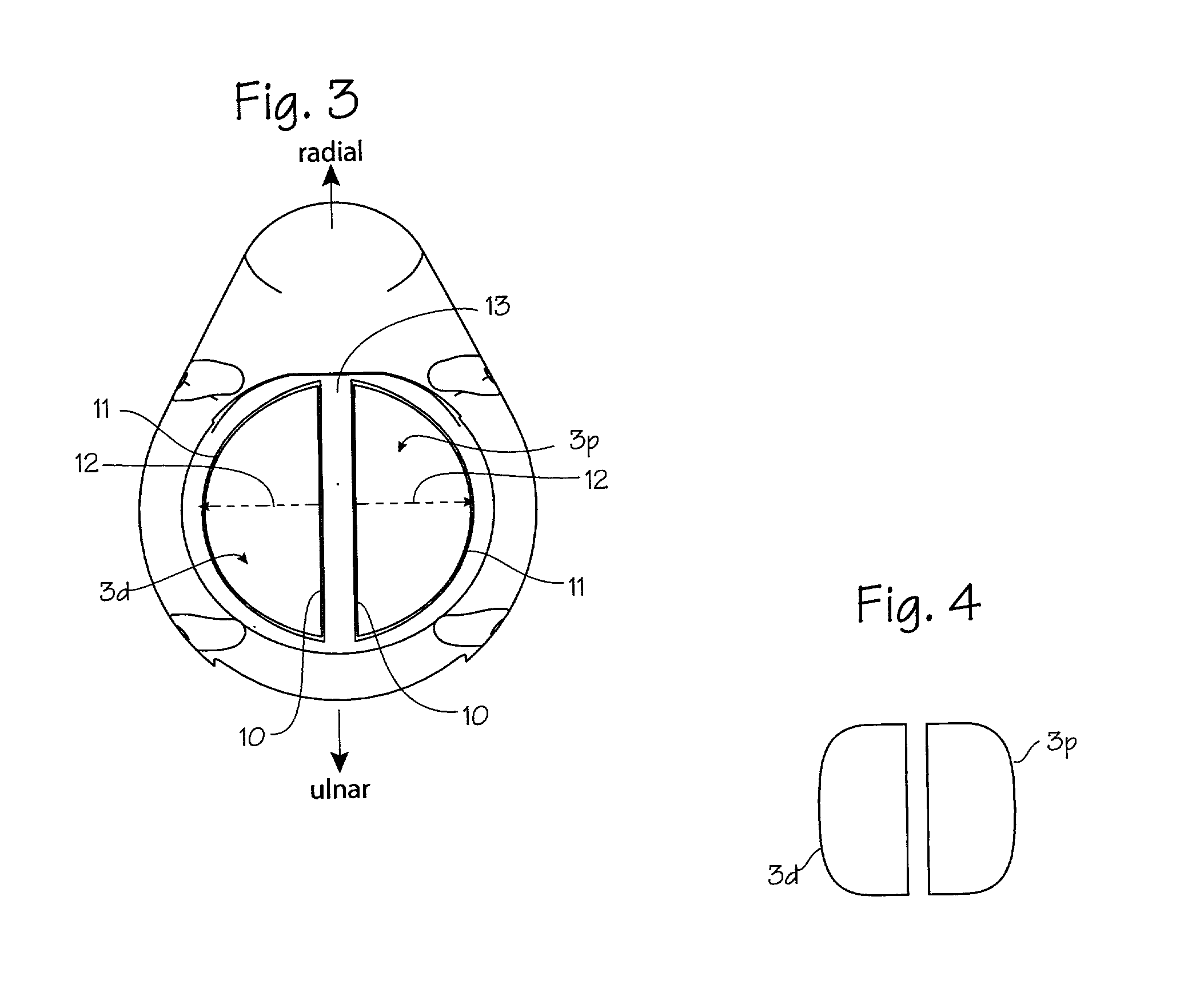 Electro-acupuncture device with D-shaped stimulation electrodes