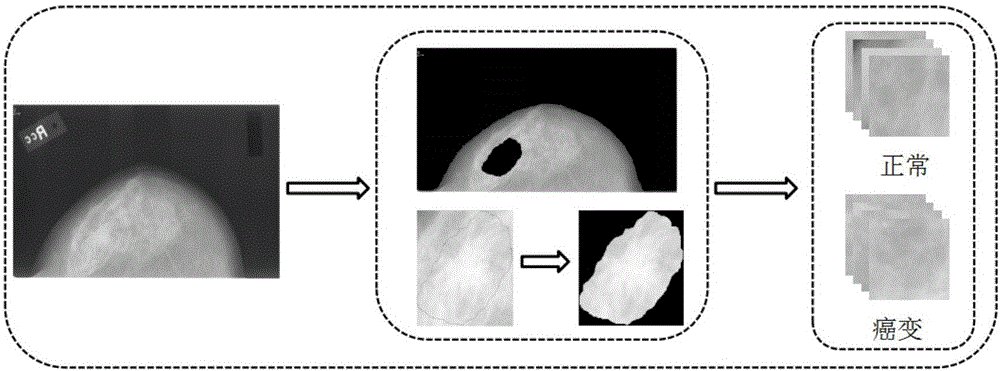 Mammary gland molybdenum target image automatic classification method based on deep learning