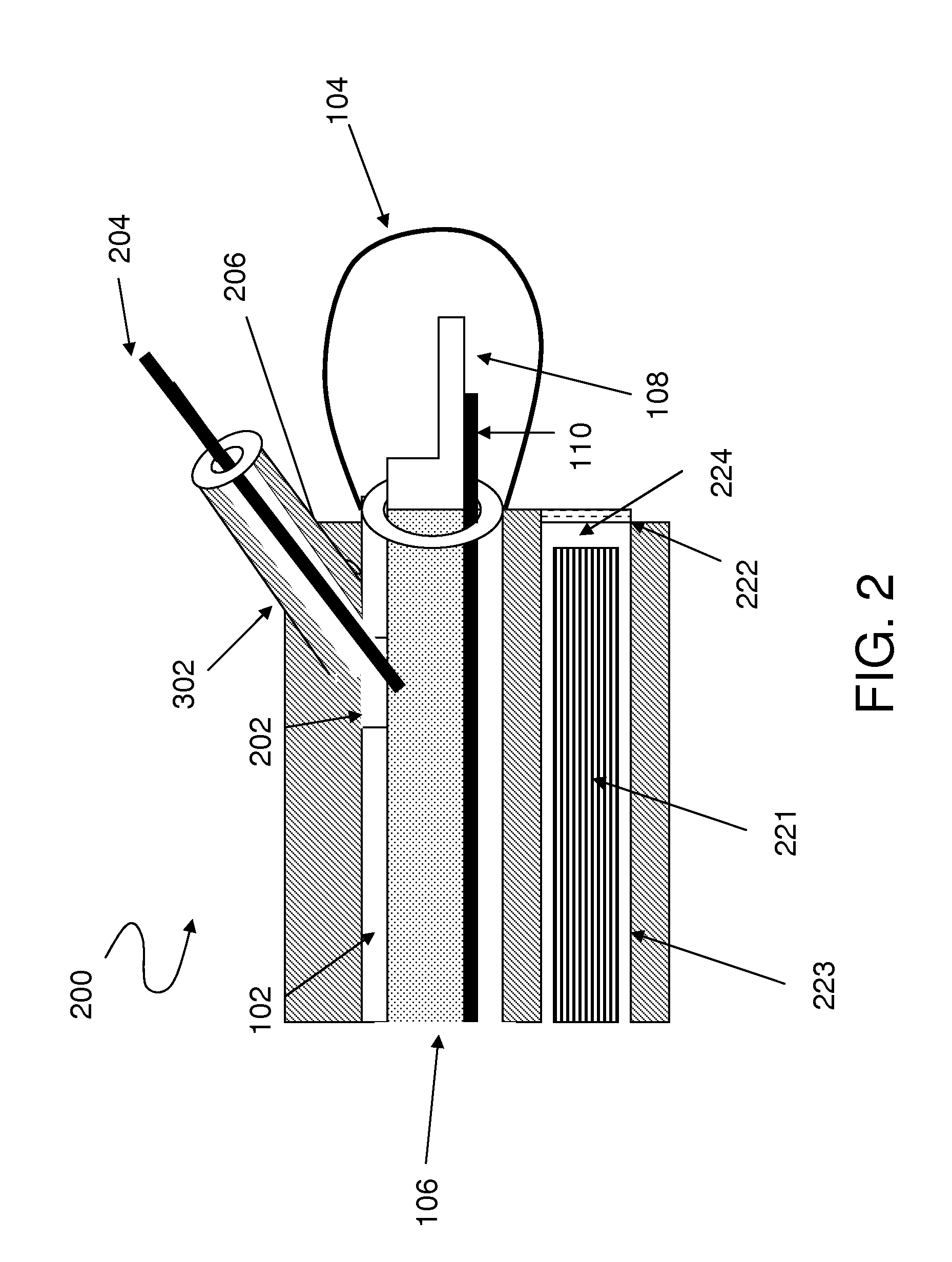 Method and system for intrabody imaging