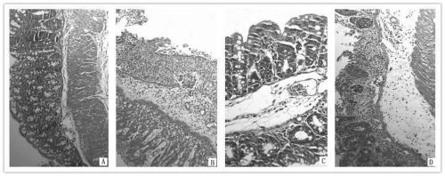 Detection method for treating inflammatory bowel disease through macrophage migration inhibitory factor resistant antibody