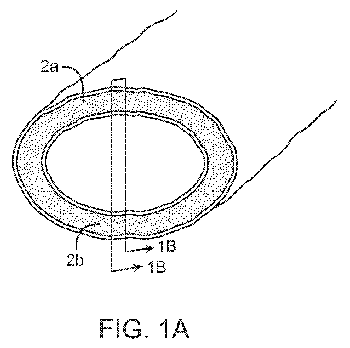 Electrosurgical instrument and method of use