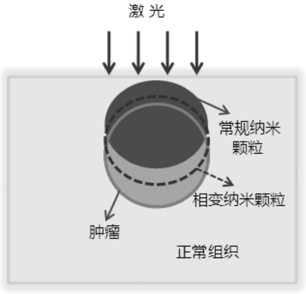 A method for passive regulation of biological tissue temperature field based on optical phase change nanoparticles