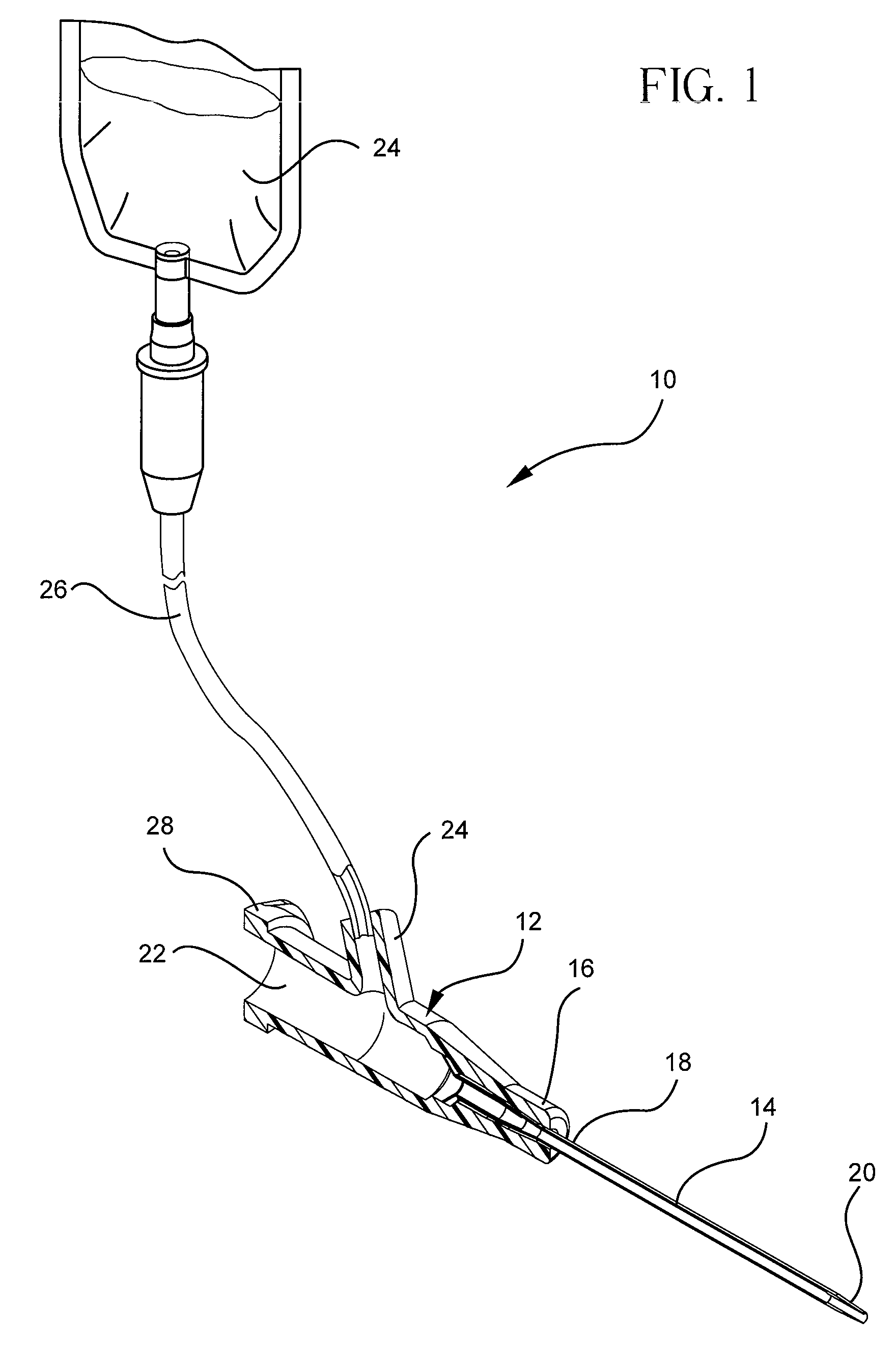 Occlusion resistant catheters