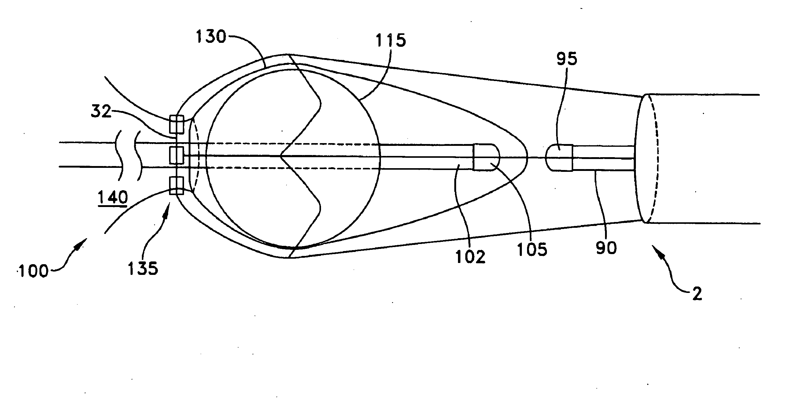Apparatus and method for the ligation of tissue