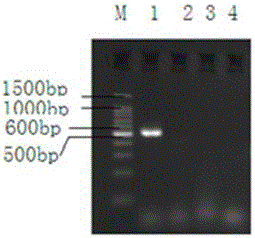 Ribosomal DNA ITS1 gene-based polymerase chain reaction (PCR) amplification kit for detecting clonorchis sinensis metacercaria and amplification primer