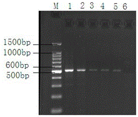 Ribosomal DNA ITS1 gene-based polymerase chain reaction (PCR) amplification kit for detecting clonorchis sinensis metacercaria and amplification primer