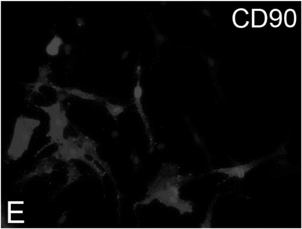 Method for sorting cardiac fibroblast CD90&lt;+&gt; subsets of mice and application of cardiac fibroblast CD90&lt;+&gt; subsets