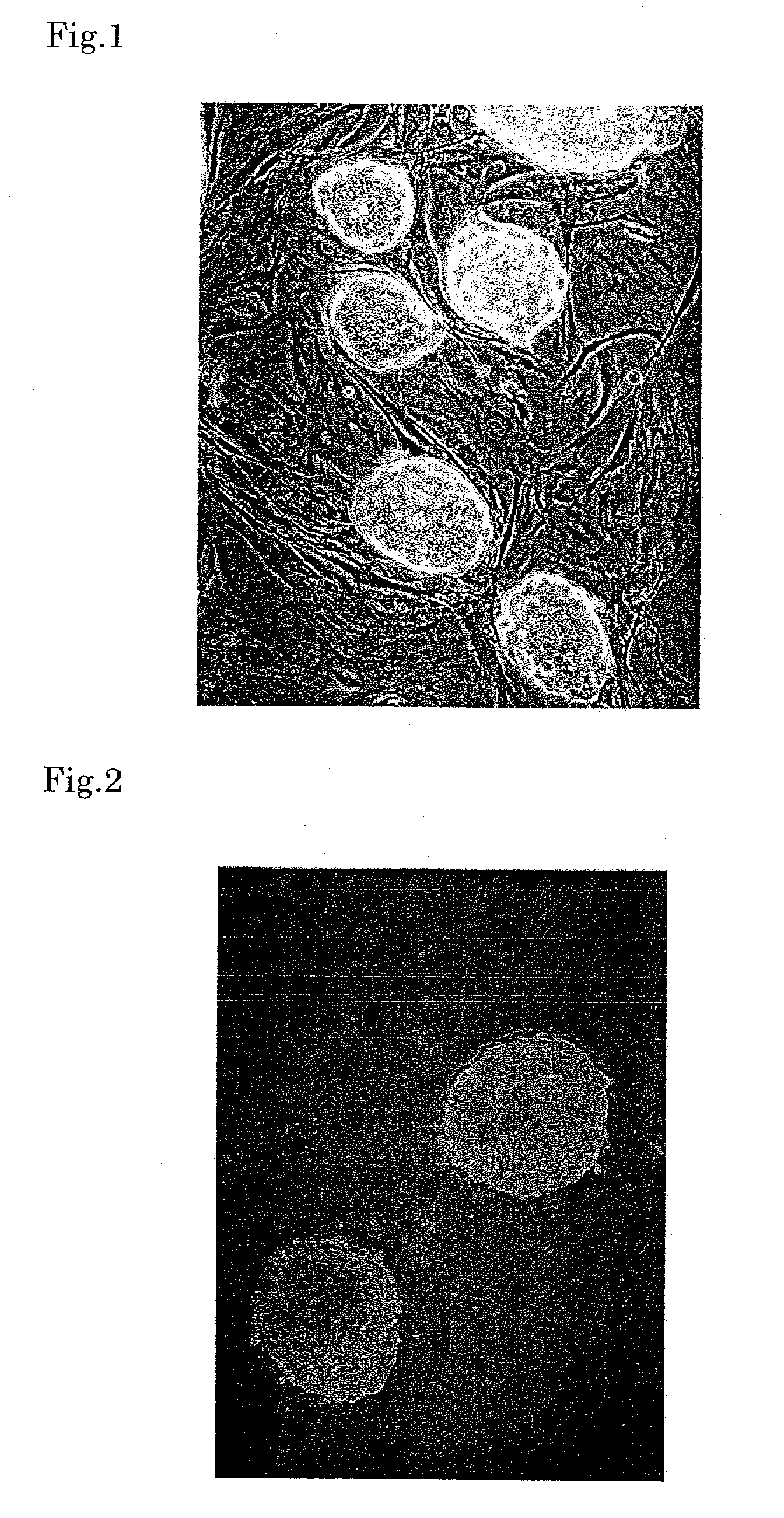 Method for forming organ