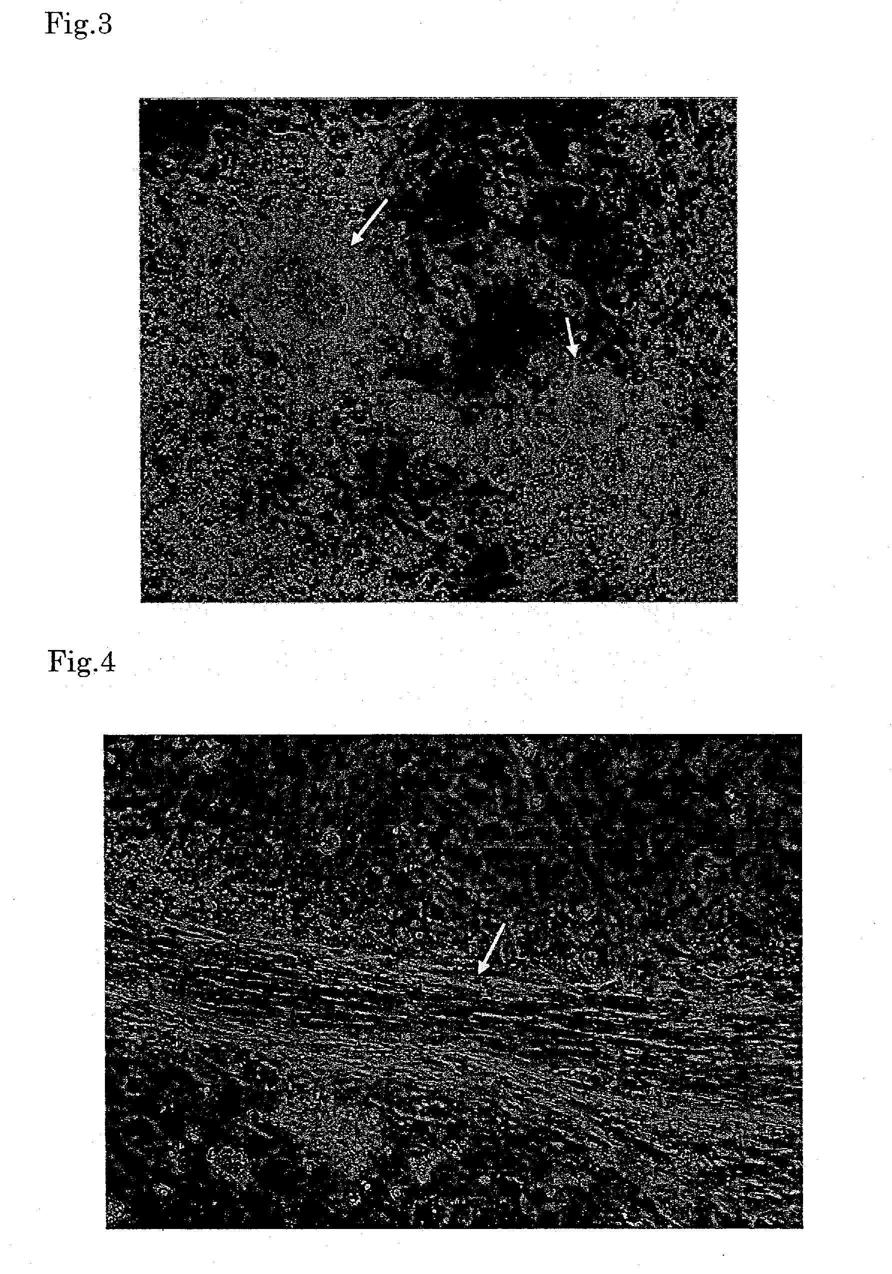 Method for forming organ