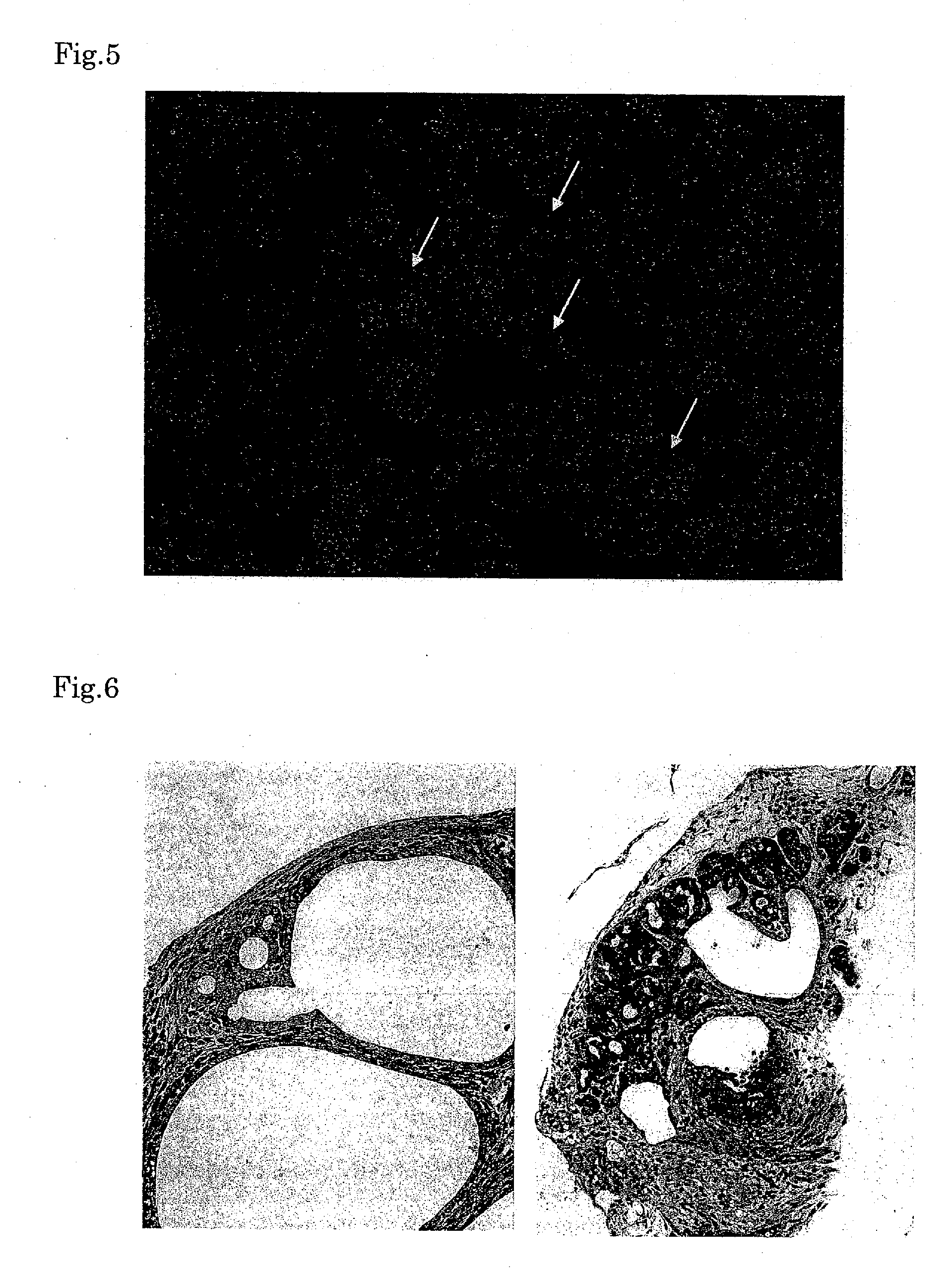 Method for forming organ