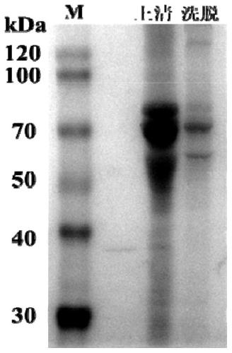 Coronavirus fusion protein, and preparation method and application thereof