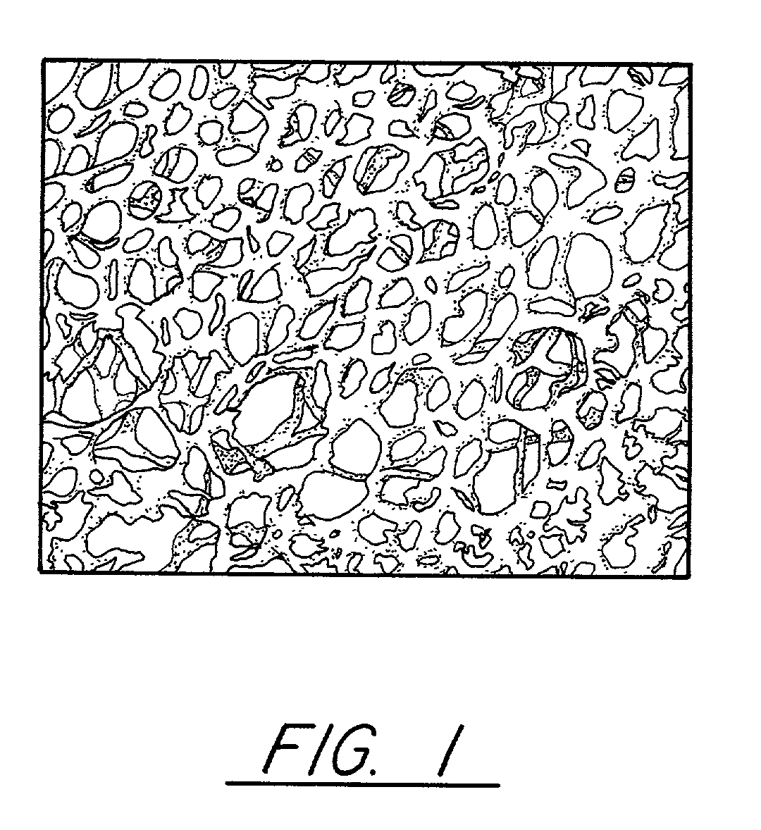 Pitch-based carbon foam and composites and use thereof