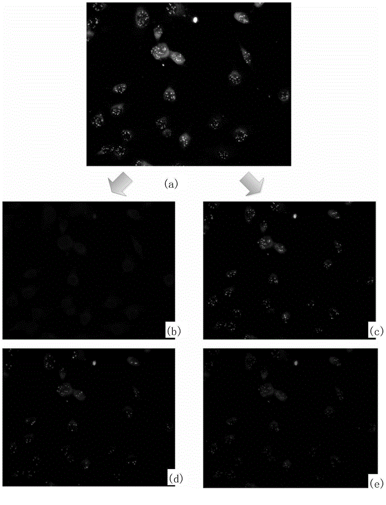 Fluorescence in situ hybridization (FISH) image parallel processing and analysis method