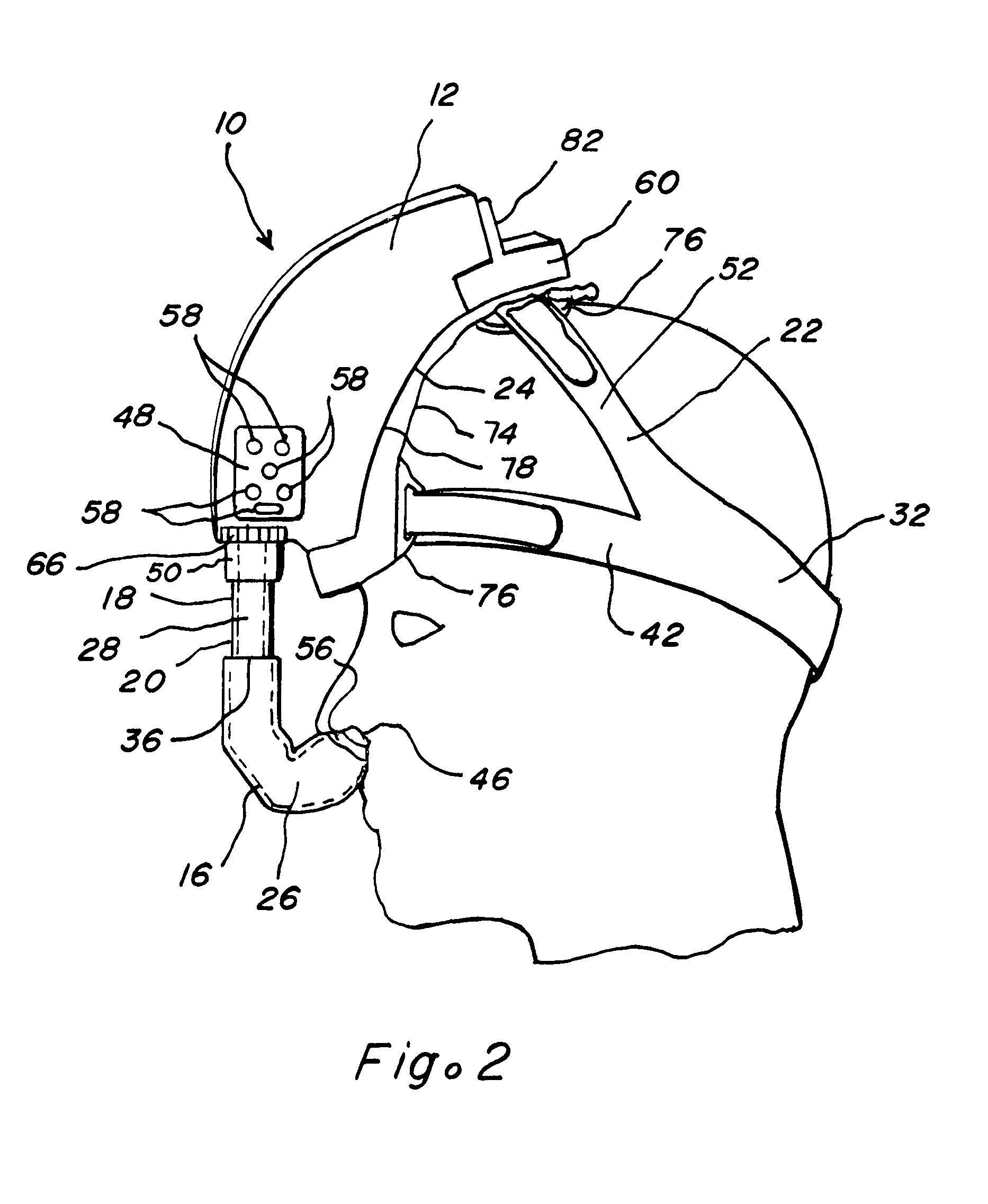 Apparatus and methods for administration of positive airway pressure therapies