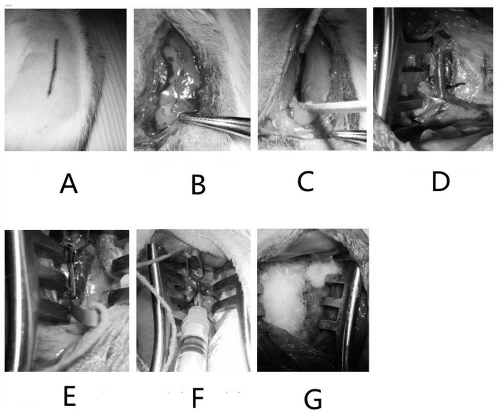 Rat infrarenal abdominal aortic aneurysm model constructed through retroperitoneal approach and construction method