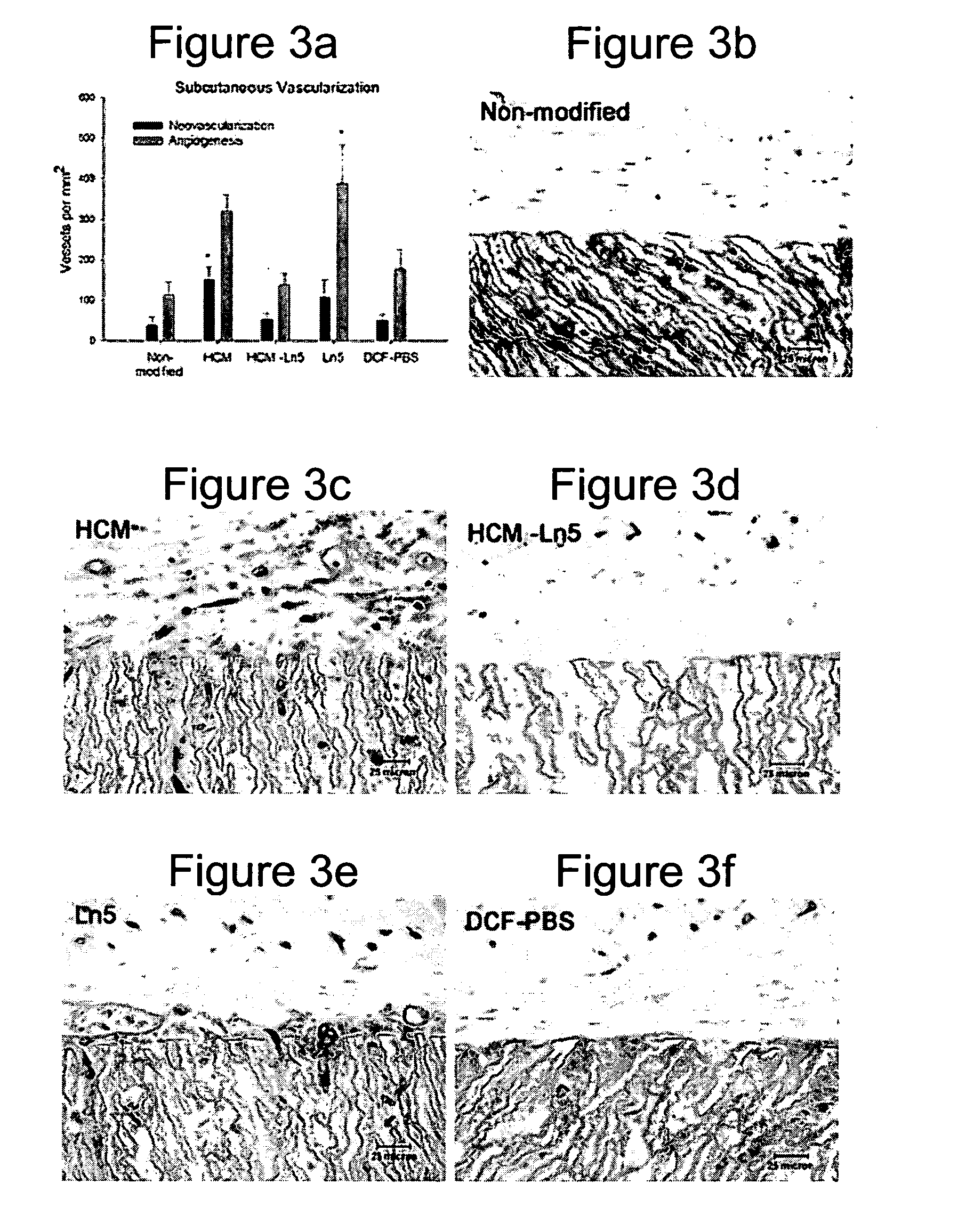 Implantable medical articles having laminin coatings and methods of use