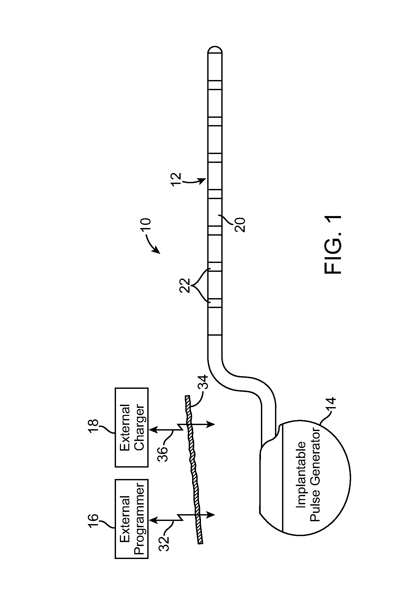 Moldable charger having hinged sections for charging an implantable pulse generator