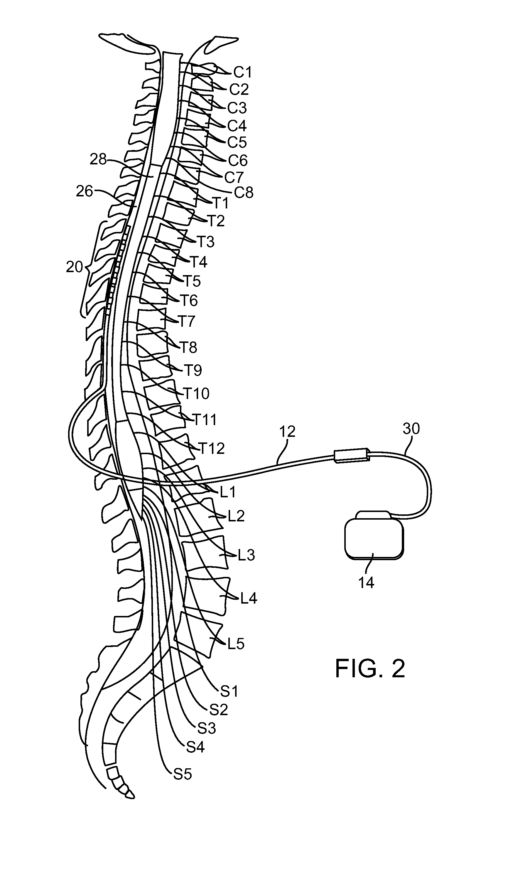 Moldable charger having hinged sections for charging an implantable pulse generator