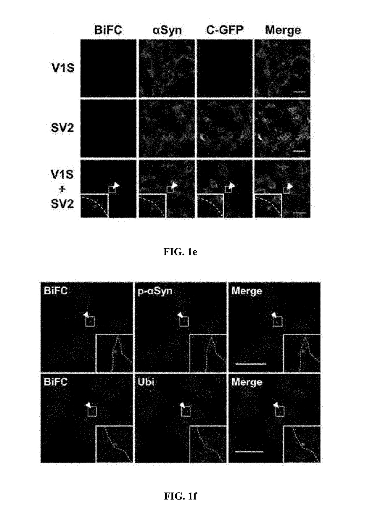Method for measuring cell-to-cell transmission of α-synuclein aggregates using bimolecular fluorescence complementation system and method for screening a substance for preventing or treating neurodegenerative disease using the same
