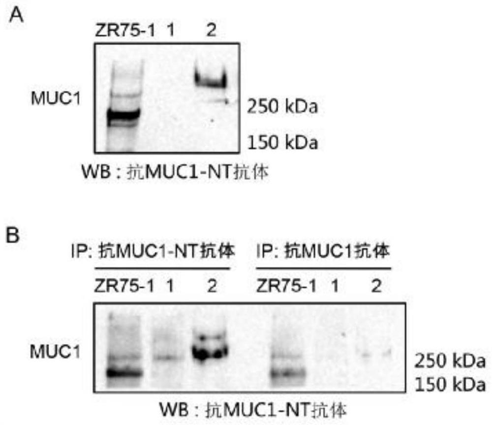 Novel chimeric antigen receptor targeting tumor cell surface muc1 and preparation method of muc1 chimeric antigen receptor T cell