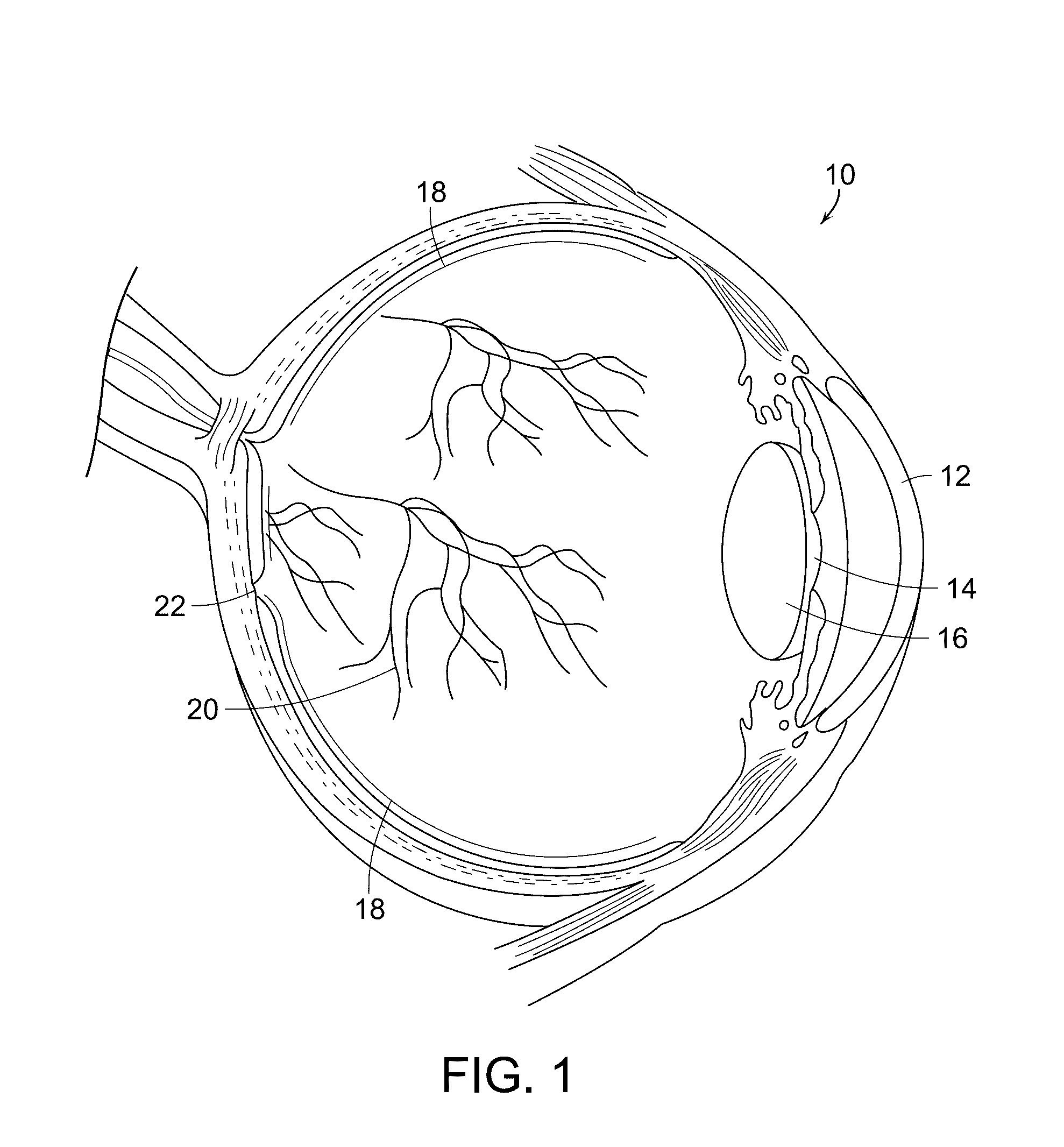 System and process for neuroprotective therapy for glaucoma