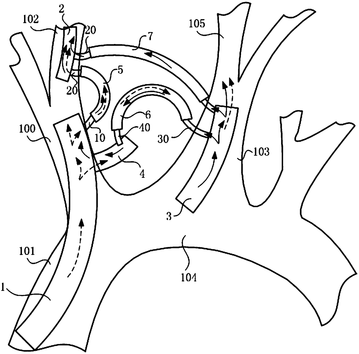 Device for intracranial bypass of aorta and bilateral internal carotid arteries