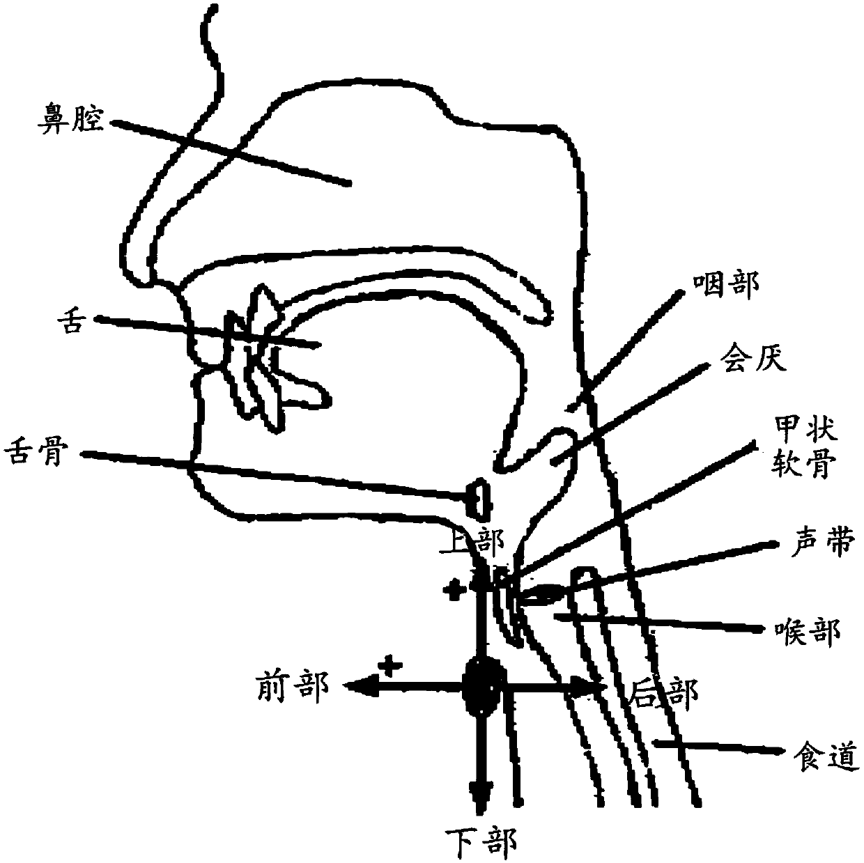 Signal trimming and false positive reduction of post-segmentation swallowing accelerometry data