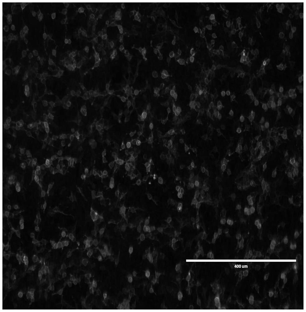 A kind of hybridoma cell line, poultry type h1n1 swine influenza virus ha protein mab, antigenic epitope and application