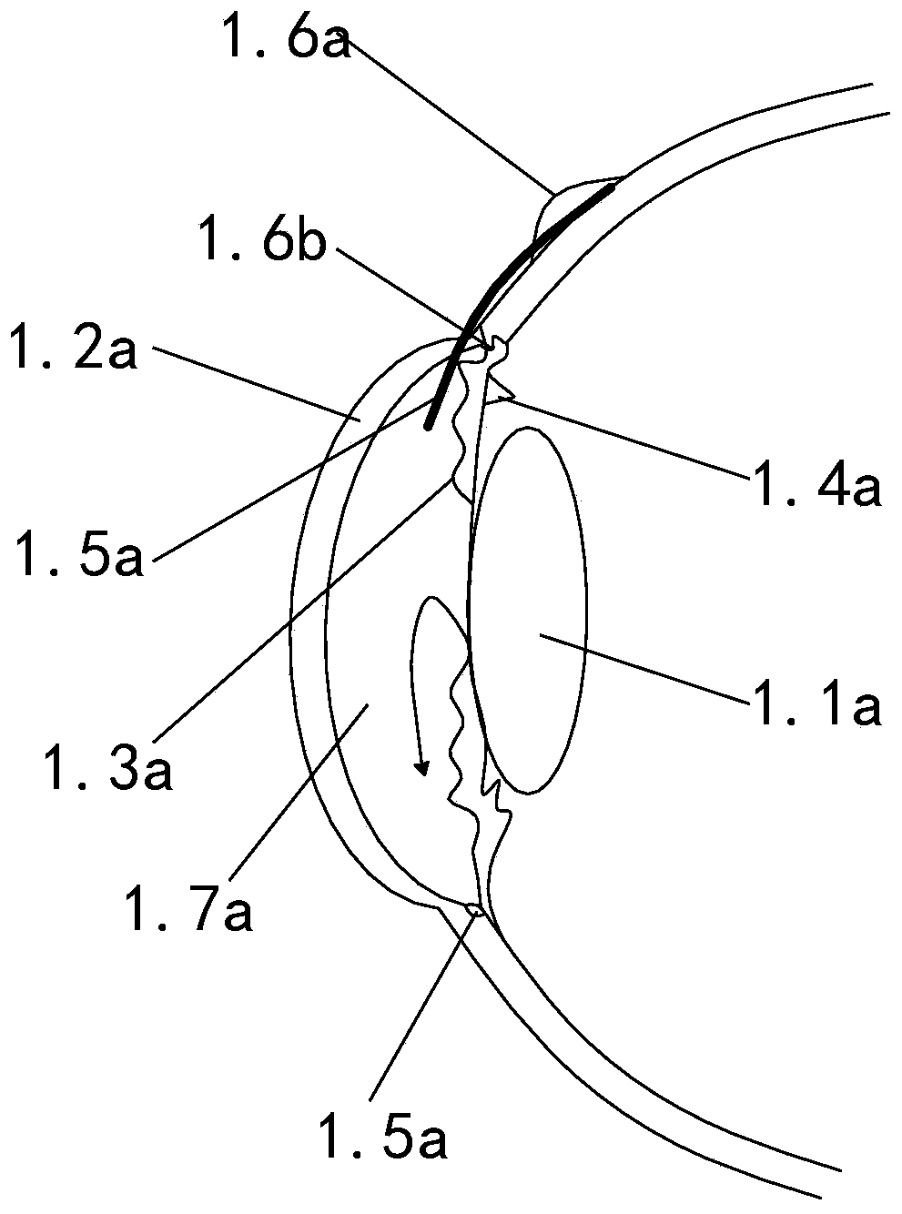 Front-arranged adjustable electromagnetic drainage valve for treating glaucoma