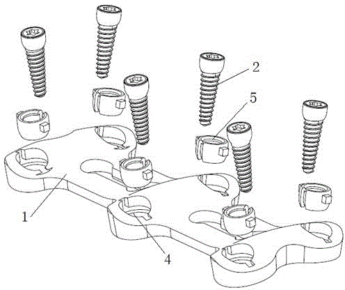 Spine fixing device