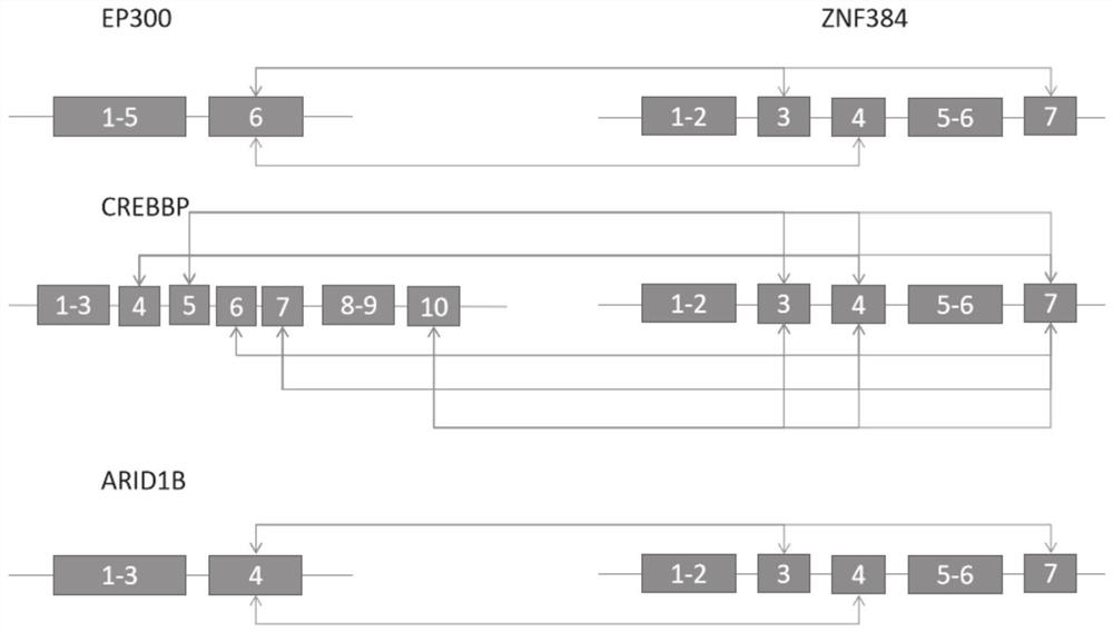 Primer and probe for detecting ZNF384-related fusion gene by multiple fluorescence PCR technology, and application