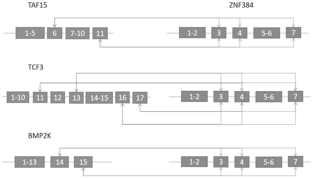 Primer and probe for detecting ZNF384-related fusion gene by multiple fluorescence PCR technology, and application